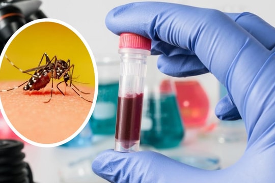 Cảnh giác với bệnh Chikungunya – “người đi khom lưng”
