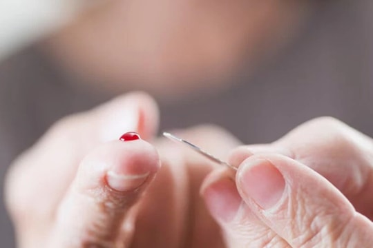 Chồng nguy kịch do vợ chích máu đầu ngón tay chữa đột quỵ