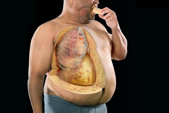 Top 10 thực phẩm hữu hiệu giúp "đốt cháy" mỡ nội tạng