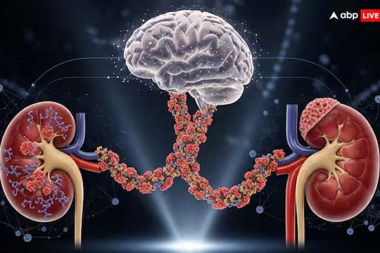 Phát hiện mới làm đảo lộn hiểu biết về nguyên nhân gây bệnh Parkinson