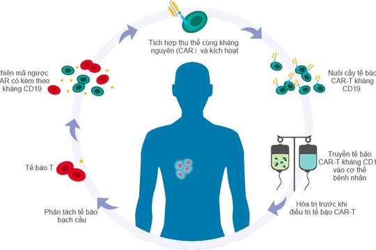 CAR-T và triển vọng điều trị ung thư tại Việt Nam