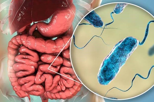 Bệnh tả trên thế giới diễn biến phức tạp, Bộ Y tế khuyến cáo