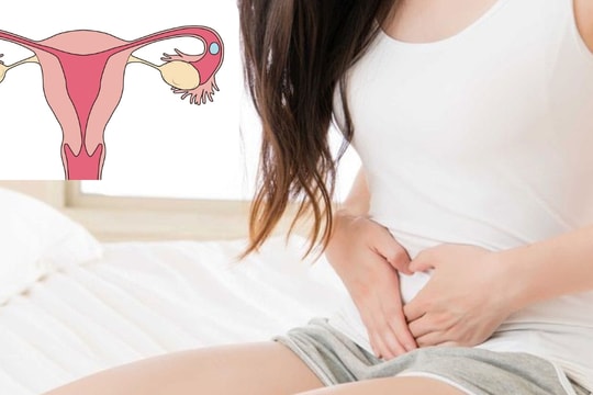 Sản phụ nguy kịch, tràn ổ bụng 1,5 lít máu do vỡ khối chửa ở vòi tử cung