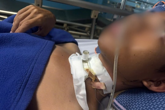 Quảng Trị: Cấp cứu bệnh nhân bị đứt khí quản do vướng dây điện khi đi đường