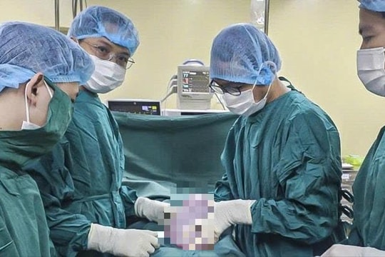 Thiếu nữ 19 tuổi mang khối u buồng trứng khổng lồ nặng 5,5kg