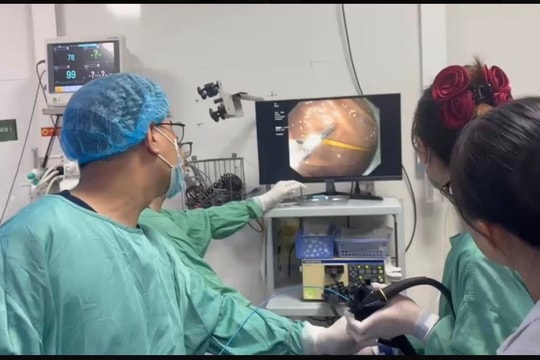 Thói quen ngậm tăm tưởng vô hại, suýt gây thủng dạ dày