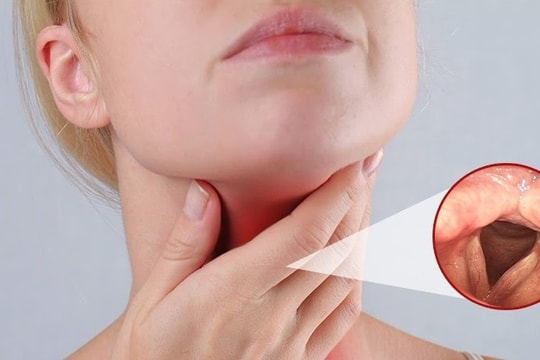 Nguy cơ mắc bệnh hô hấp sau bão lũ và biện pháp phòng ngừa