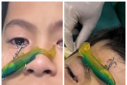 Bé trai suýt mù mắt khi đi câu cá