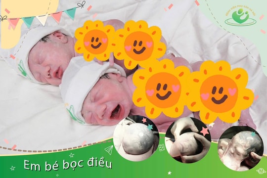 Ca sinh đôi chào đời với bọc ối còn nguyên