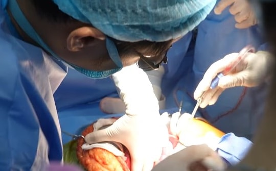 Ca ghép gan hồi sinh bệnh nhân từng "chờ chết"