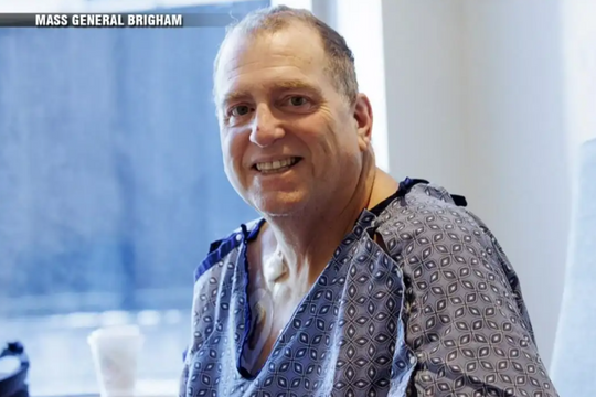 Kỷ lục: Bệnh nhân sống khỏe 9 tháng với thận lợn chỉnh sửa gen