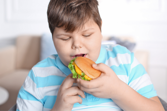 Béo phì ở trẻ em ngày càng phổ biến, bác sĩ khuyến cáo