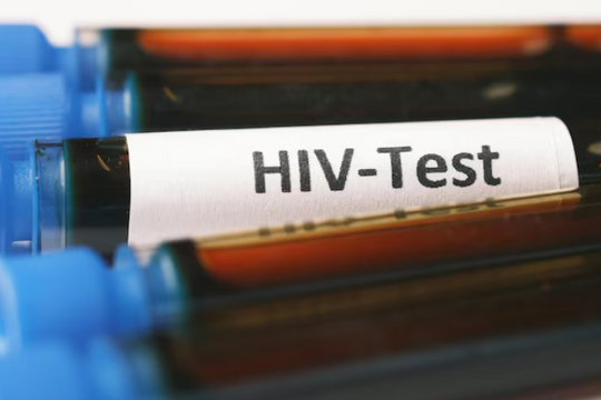 Hướng đi mới hứa hẹn chữa khỏi hẳn HIV