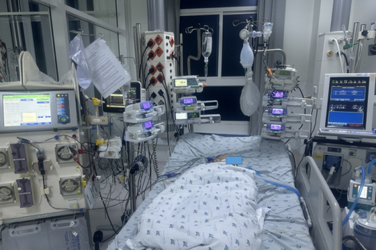 Lọc máu liên tục cứu sống trẻ bị bệnh tay chân miệng nặng