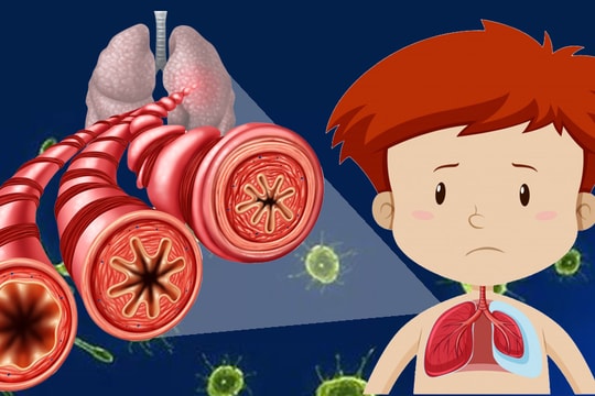 Cha mẹ cần biết để phòng viêm phổi cho trẻ