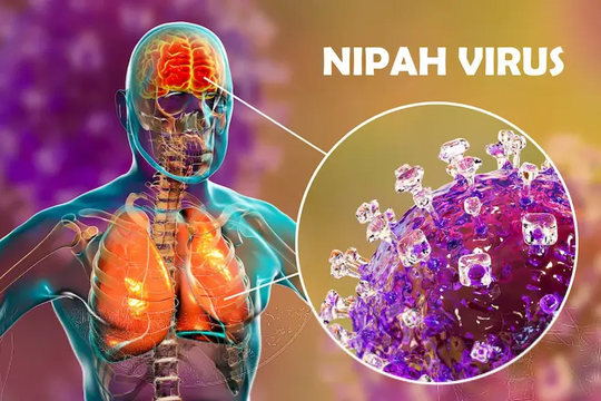 WHO nói gì về virus Nipah?