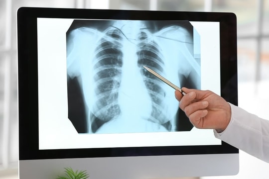 Bộ Y tế đề nghị thanh toán bảo hiểm y tế kỹ thuật điện quang không phụ thuộc vào thời gian chụp chiếu