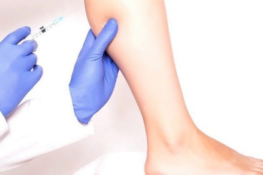 Cẳng chân người phụ nữ biến dạng do tiêm filler tại nhà, bác sĩ cảnh báo trào lưu độc hại