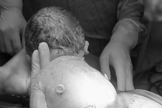 Em bé chào đời cùng “đôi cánh tí hon” sau hành trình giành sự sống