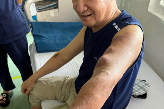 Bệnh viện C Đà Nẵng: Can thiệp thành công ca thuyên tắc tĩnh mạch chi trên thành công đầu tiên tại miền Trung