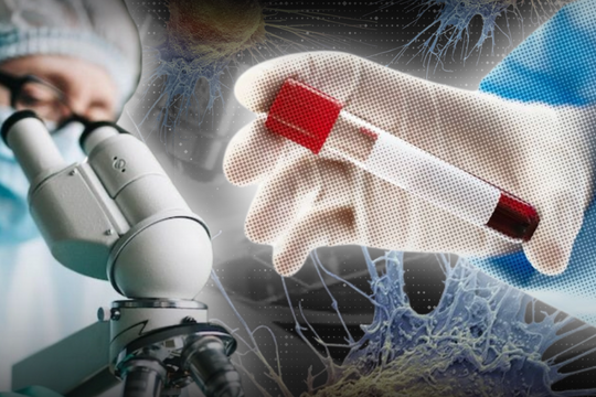 Đột phá xét nghiệm máu: Tầm soát ung thư chỉ trong một lần thử