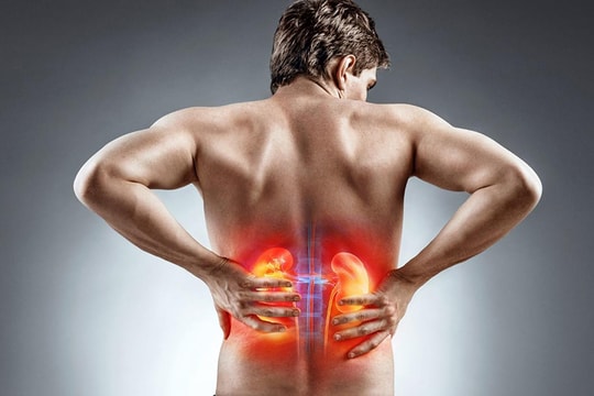 Bị hội chứng thận hư, ăn gì để giảm phù và bảo vệ thận?