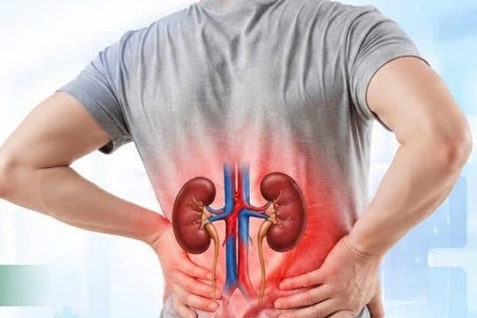 Người trẻ vô tư “hủy hoại” thận vì những thói quen hàng ngày, bác sĩ cảnh báo
