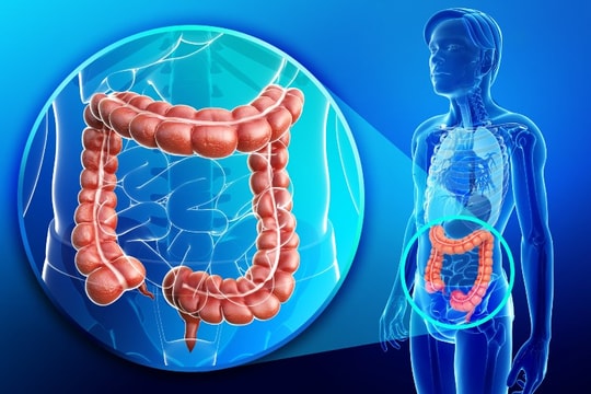 Bác sĩ cảnh báo dấu hiệu ung thư đại trực tràng dễ bị bỏ qua