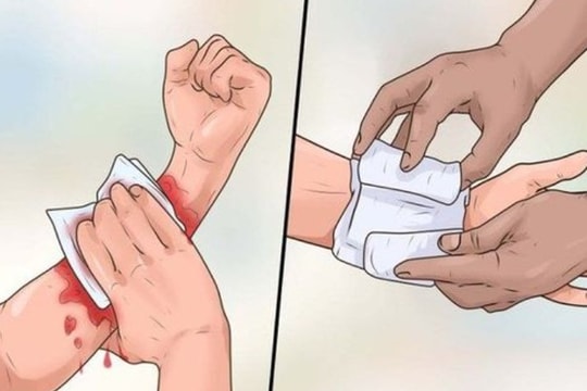 Đắp lá chữa vết thương, bệnh nhân tử vong vì uốn ván