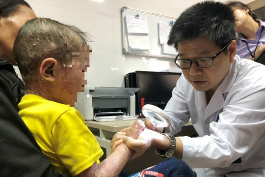 Gieo hy vọng cho những phận đời yếu thế Bài 1: Lặng thầm xoa dịu nỗi đau vảy nến