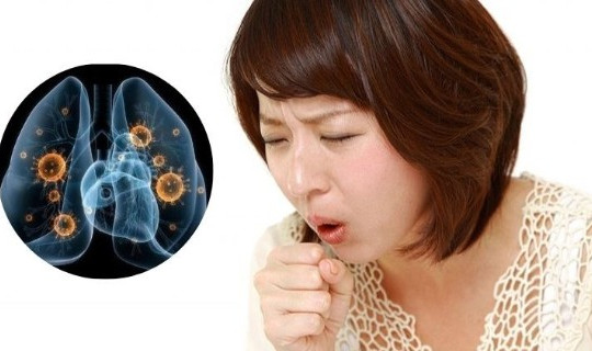 Bệnh lao âm thầm gia tăng, bác sĩ khuyến cáo người trẻ không nên chủ quan