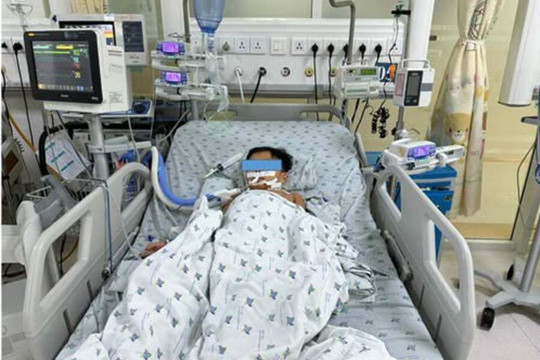 Ăn thịt chuột nhiều ngày, 3 chị em ngộ độc siêu warfarin