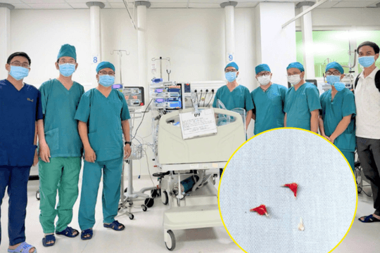 Hai bệnh viện phối hợp lấy thành công 3 mảnh xương lươn cho bé 7 tháng tuổi