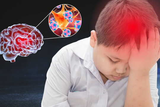 Hà Nội ghi nhận 2 ca não mô cầu, chủ động phòng bệnh từ những dấu hiệu sớm