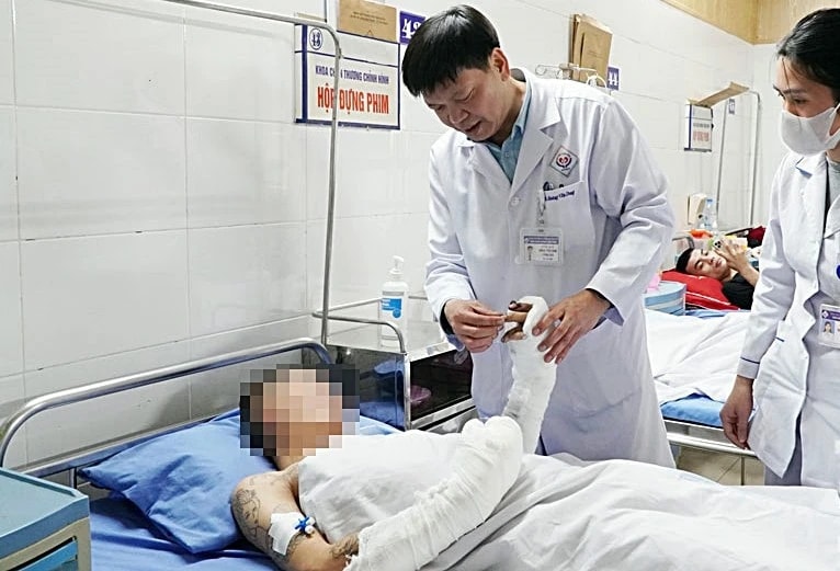 Bị dập vỡ nhãn cầu do tự chế pháo nổ