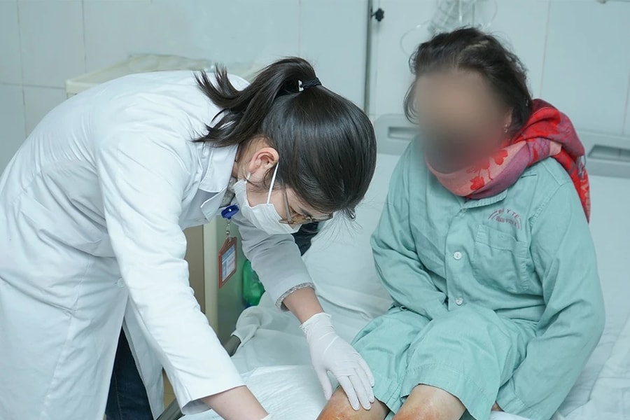 Bác sĩ cảnh báo không dùng bột lá ngâm rửa, đắp da: nguy cơ viêm da tiếp xúc dị ứng