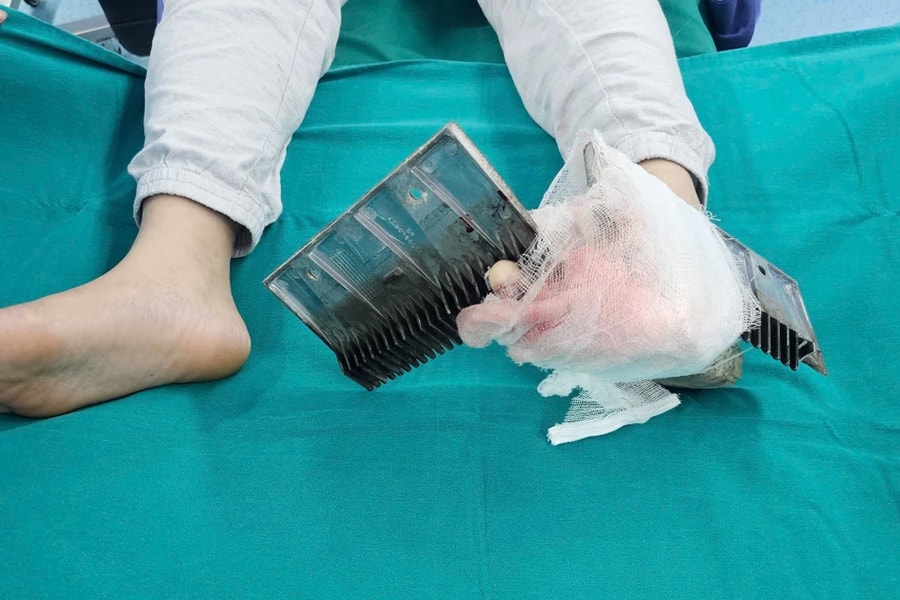 Hà Nội: Bé trai 12 tuổi bị kẹt chân thang cuốn của trung tâm thương mại