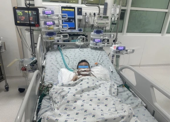 Cứu sống thành công bệnh nhi chấn thương vỡ khí quản hiếm gặp