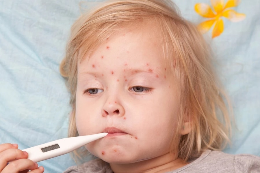 Nắng nóng kéo dài, cần chú ý các bệnh cho trẻ