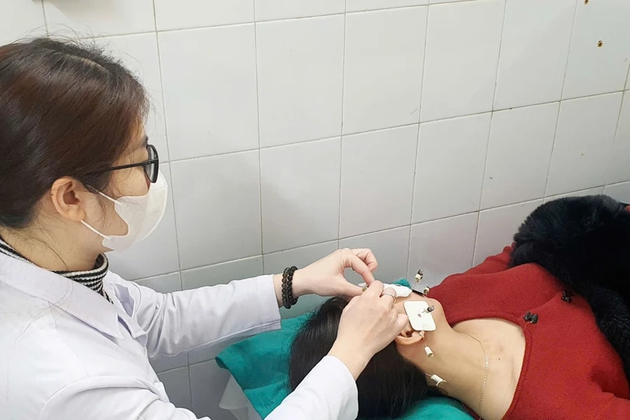 Cách điều trị liệt dây thần kinh số VII ngoại biên bằng Y học cổ truyền hiệu quả