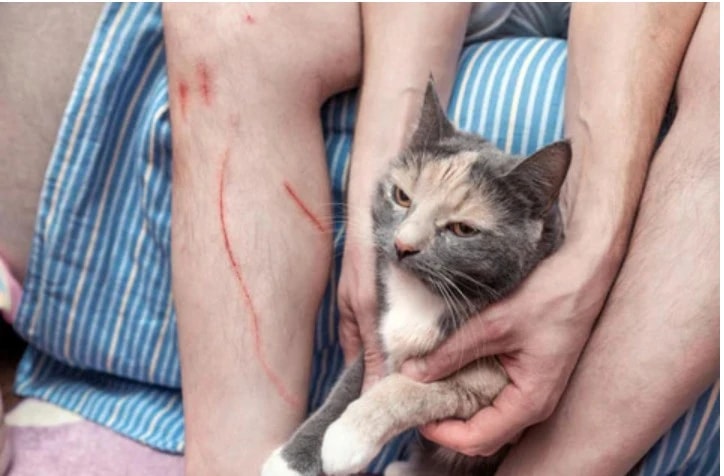Người đàn ông tử vong sau khi bị mèo cào