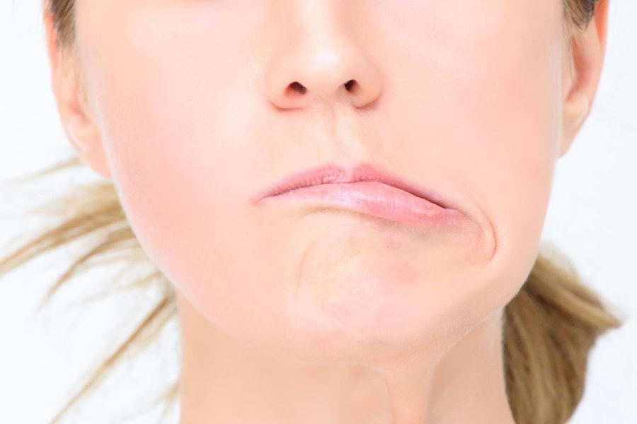 Cảnh báo bệnh liệt mặt mùa nóng nếu dùng quạt, điều hòa sai cách