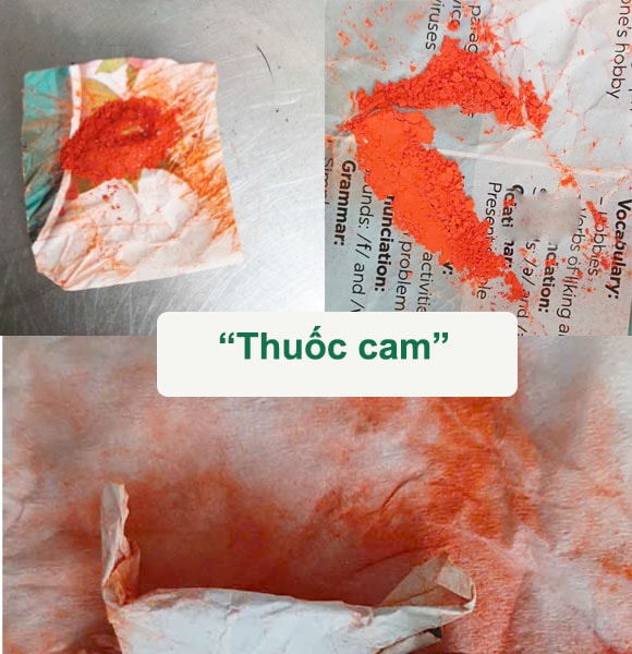 Bé gái 5 tuổi ngộ độc chì vì dùng “thuốc cam” trị viêm da