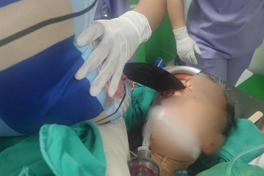 Người đàn ông thoát chết "ngoạn mục" sau khi bị lưỡi dao máy cắt dài 50cm cắm xuyên sọ não