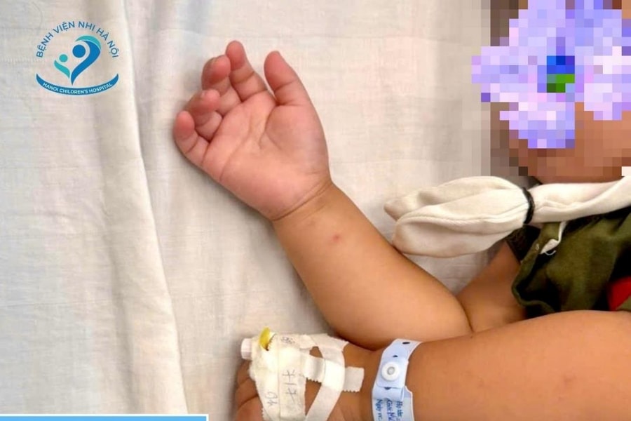 Cứu bé gái 26 tháng tuổi uống nhầm thuốc diệt nấm vì tưởng kẹo thạch