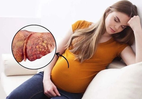 Cứu sống sản phụ mắc bệnh hiếm cực nguy hiểm