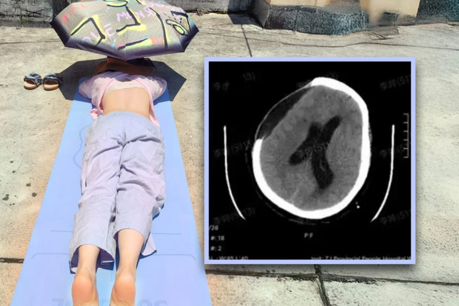 Tắm nắng giữa trưa để tăng cường sức khỏe, một phụ nữ suýt mất mạng