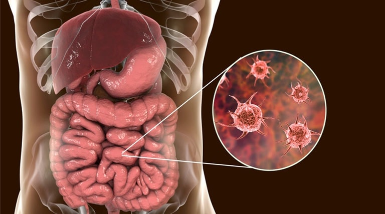 Bộ Y tế khuyến cáo phòng bệnh lỵ a-míp từ nguồn nước và thực phẩm