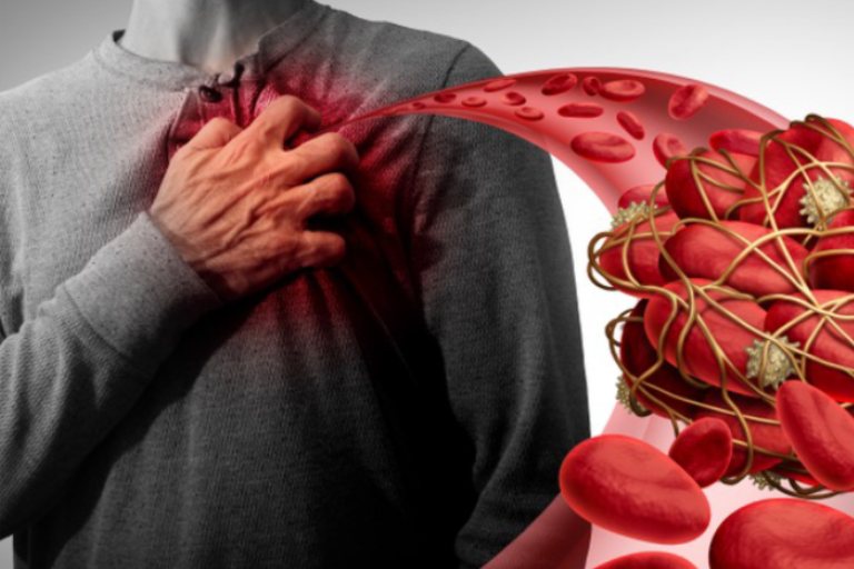 Bác sĩ tim mạch cảnh báo, mối nguy thầm lặng ảnh hưởng tính mạng từ thói quen đơn giản