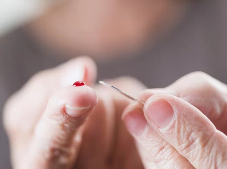 Chồng nguy kịch do vợ chích máu đầu ngón tay chữa đột quỵ